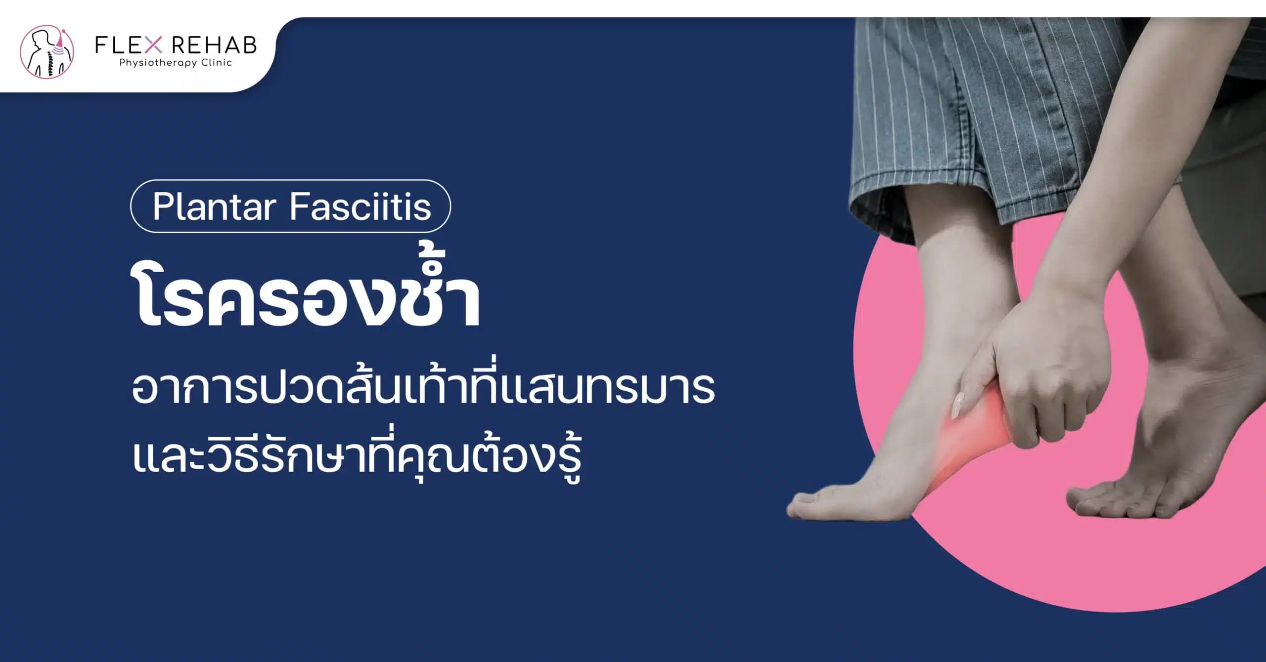 โรครองช้ำ (Plantar Fasciitis) อาการปวดส้นเท้าที่แสนทรมาร และวิธีรักษาที่คุณต้องรู้